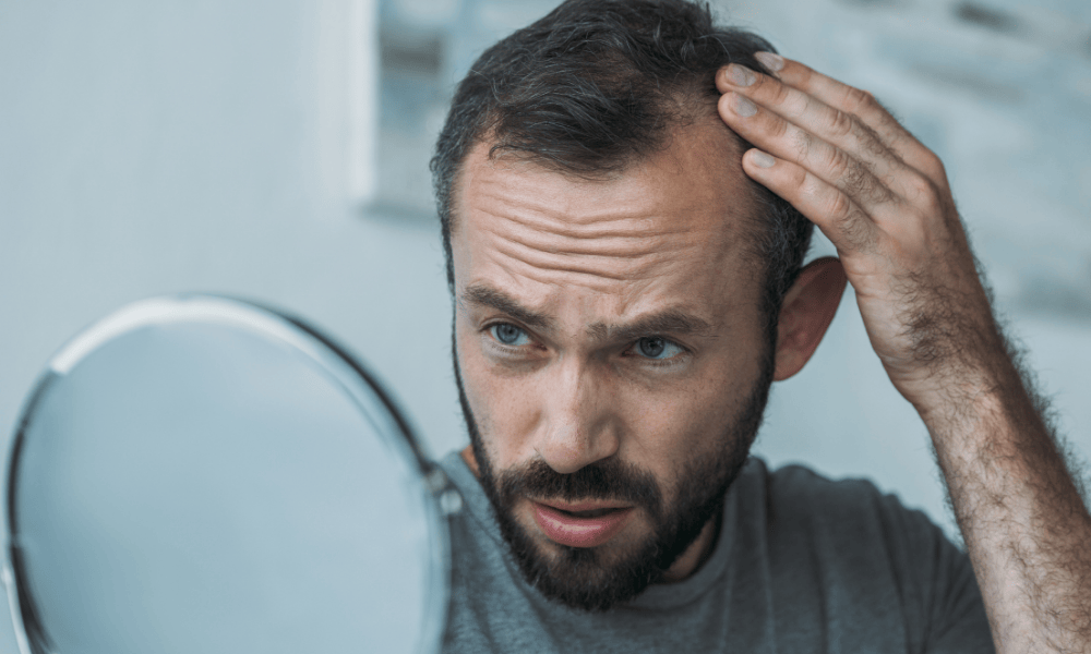 Hvorfor mister man håret? 7 almindelige årsager og hvad du kan gøre